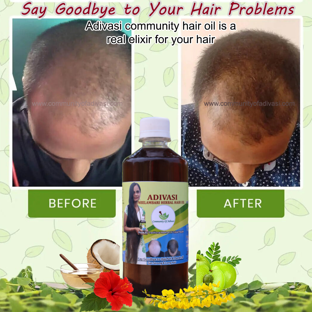 Adivasi Herbal Hair Oil All Variants